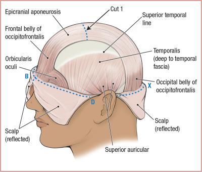 thumbs/Superficial Skull.jpeg.jpg